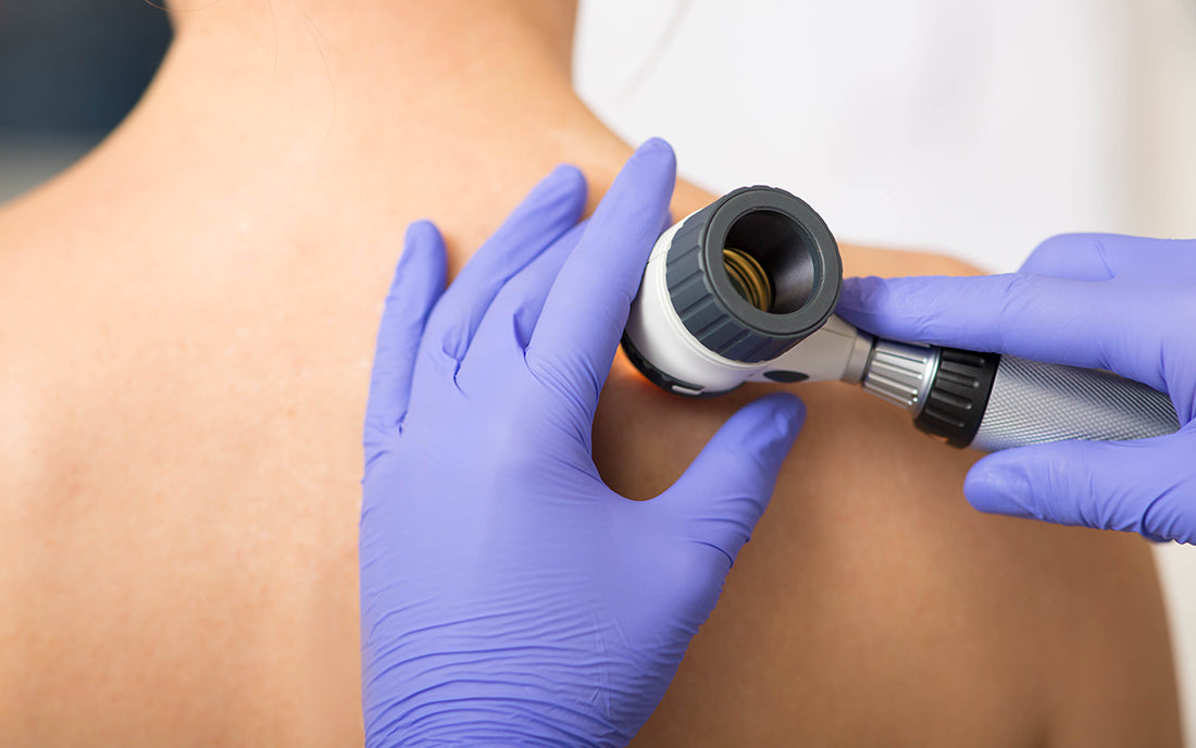 A doctor conducts a skin check