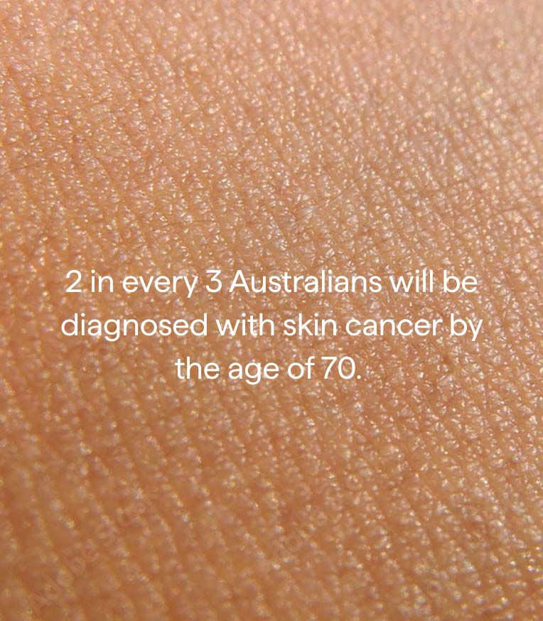 Text on skin texture background about skin cancer statistics